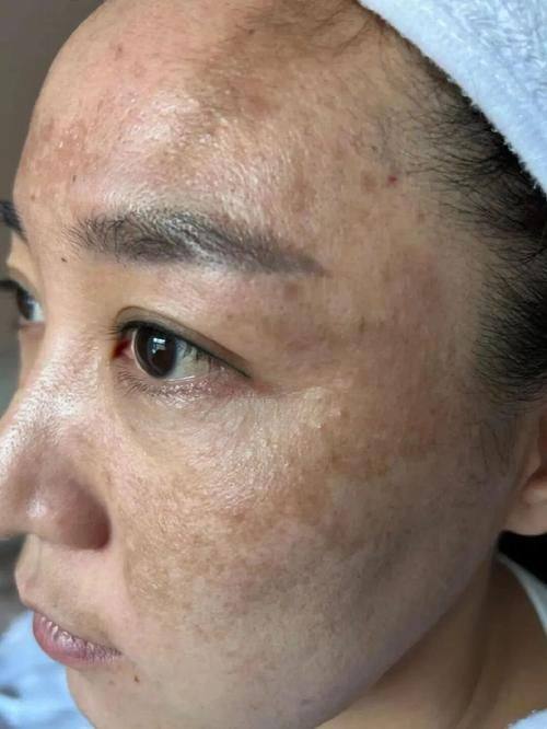 侯艳萍医生预约挂号