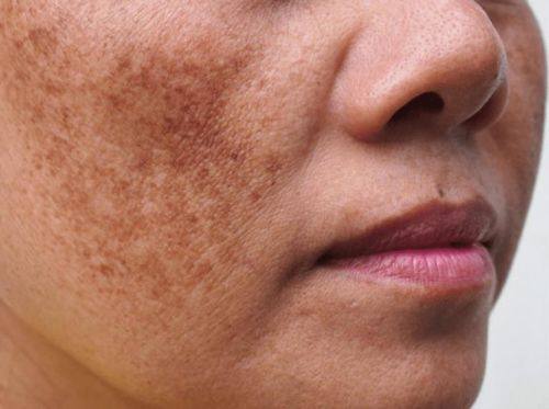 侯艳萍医生技术优势