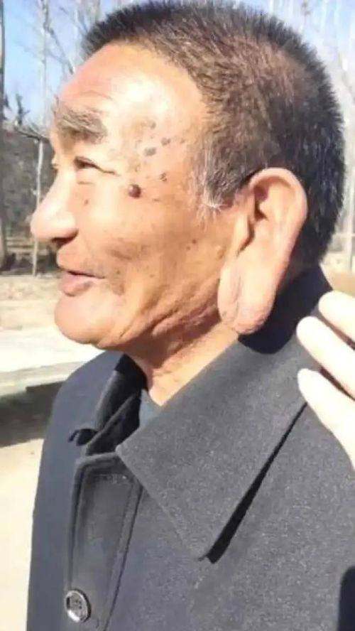 厦门思明李如英天使医学美容医院真人口碑评价怎么样？