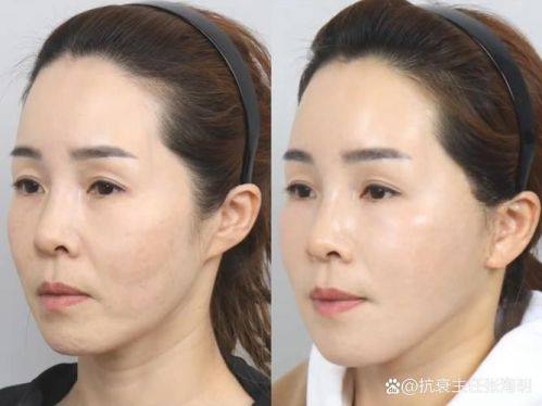 哈尔滨王医生医学美容门诊部特色项目及技术优势