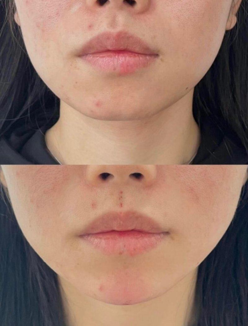 乐清奥拉克医疗美容诊所收费价格表/收费标准