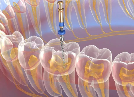 深圳李焕球口腔诊所是正规医院吗？
