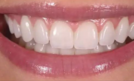 盱眙县牙博仕口腔门诊部真人口碑评价怎么样？