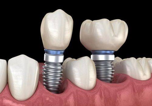 广东中山郑刘卫劲口腔是正规医院吗？