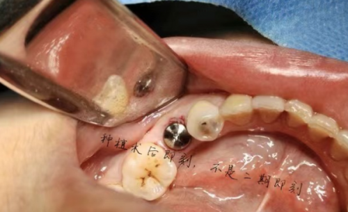 广东中山郑刘卫劲口腔医生团队实力强大及骨干医生简介