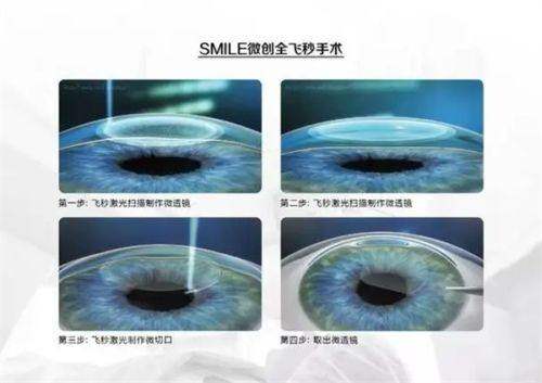 丹东郭氏眼科医院详细的预约挂号方式及流程