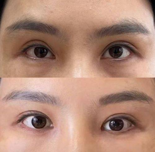 长野医美诊所特色项目及技术优势