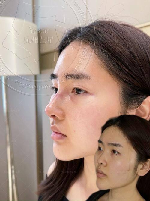 长野医美诊所是正规医院吗？