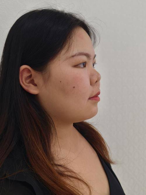 湖南国颜医疗美容特色项目及技术优势