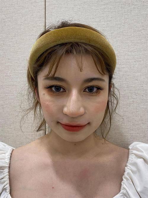 长野医美诊所真人口碑评价怎么样？