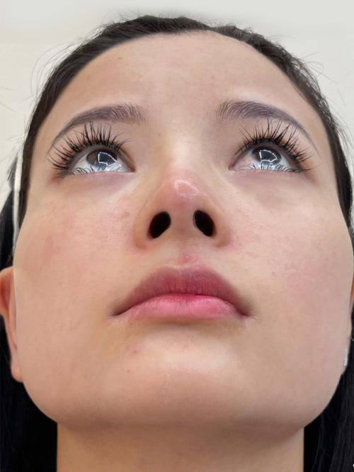 滨州医学校附属医院美容医学部详细的预约挂号方式及流程