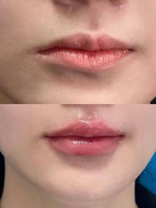 滨州医学校附属医院美容医学部收费价格表/收费标准