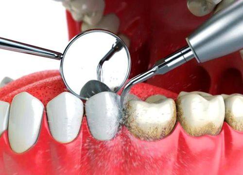 北京维嘉口腔诊所（通州万达店）详细的预约挂号方式及流程