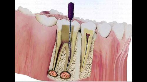 汕头市天使口腔·龙湖总院真人口碑评价怎么样？