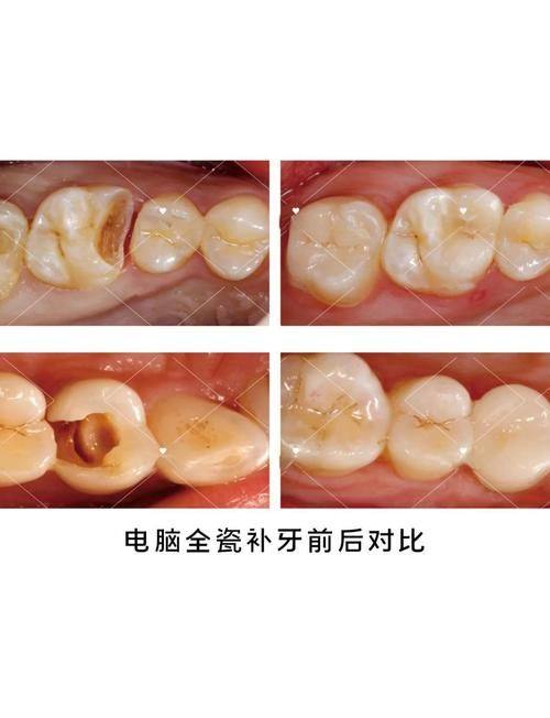 北京维嘉口腔诊所（通州万达店）真人口碑评价怎么样？