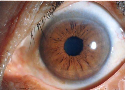 杭州市红十字会医院眼科真人口碑评价怎么样？