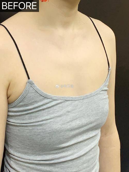 湖南国颜医疗美容是正规医院吗？