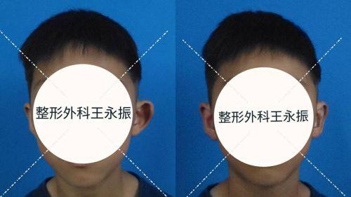 北京贝拉国内外整形医疗美容中 心详细的预约挂号方式及流程