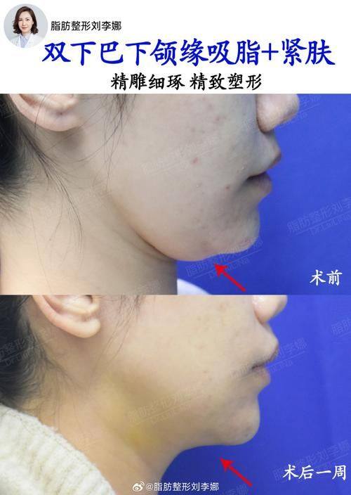 北京贝拉国内外整形医疗美容中 心收费价格表/收费标准