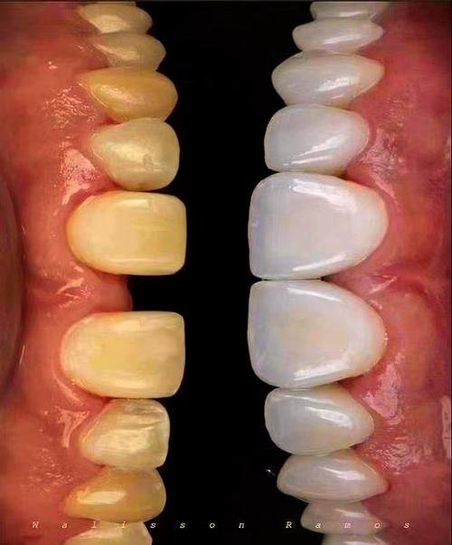 甘肃兰州榆中县宏泰口腔详细的预约挂号方式及流程