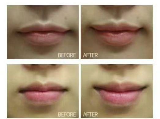 北京贝拉国内外整形医疗美容中 心真人口碑评价怎么样？