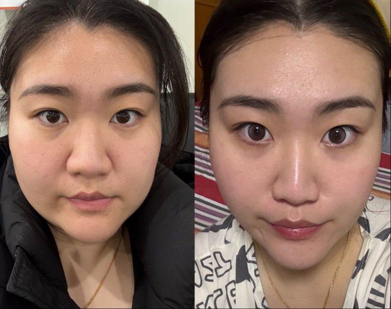 湖南国颜医疗美容真人口碑评价怎么样？