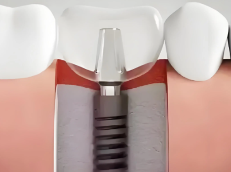 广东中山郑刘卫劲口腔详细的预约挂号方式及流程
