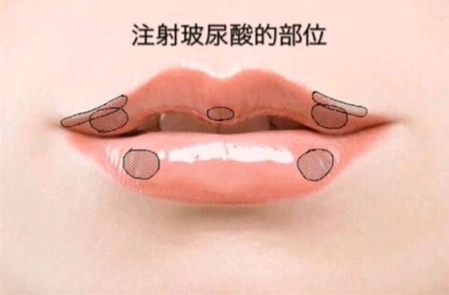 佛山医美恩整形医院是正规医院吗?