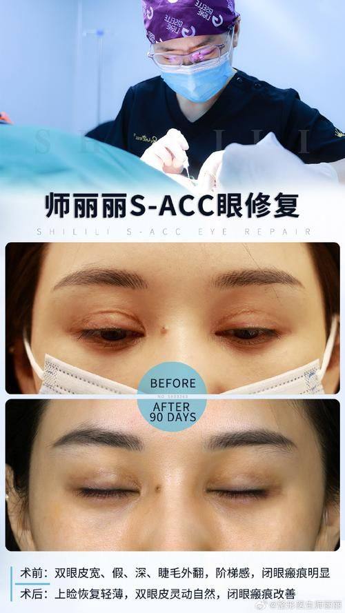 昆明彼心医疗整形美容详细的预约挂号方式及流程