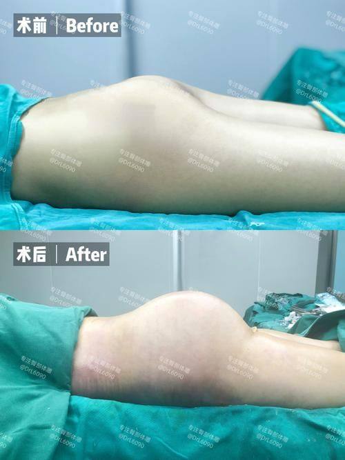 国内台湾菲仕美医疗美容诊所收费价格表/收费标准