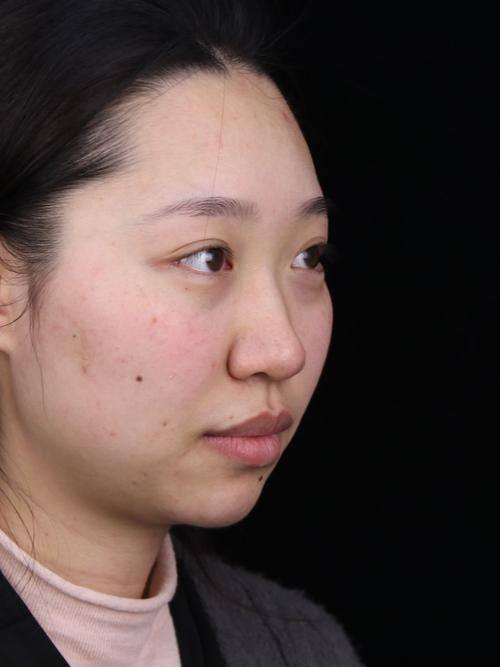 顺德港美修复医院整形美容科地址电话营业时间