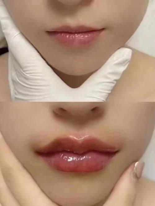 佛山医美恩整形医院地址电话营业时间