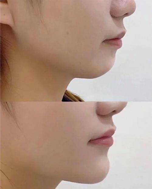 佛山医美恩整形医院收费价格表/收费标准