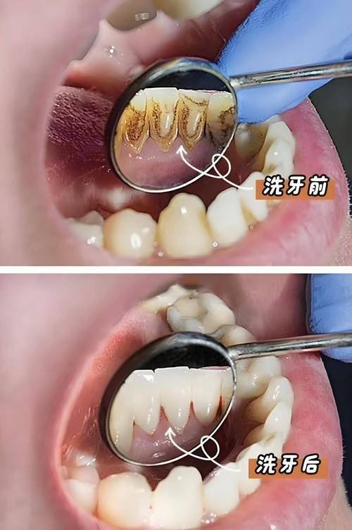 江阴摩尔口腔医院(江阴店)收费价格表/收费标准