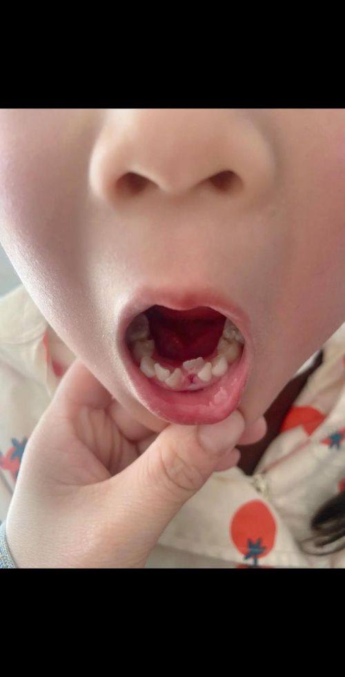 湖南娄底鸿兴口腔特色项目及技术优势