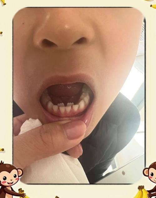 湖南娄底鸿兴口腔收费价格表/收费标准