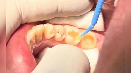 沈阳医学校附属第二医院和平院区口腔科特色项目及技术优势