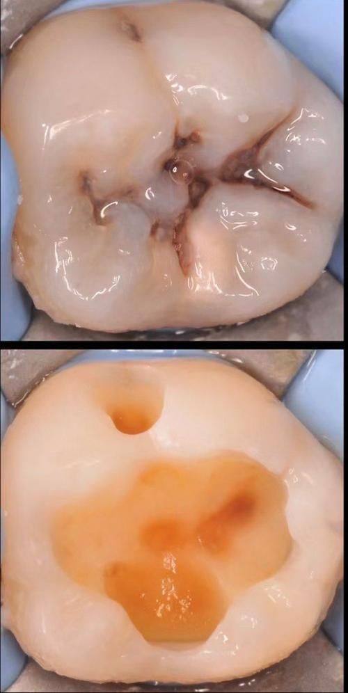 江阴摩尔口腔医院(江阴店)是正规医院吗?