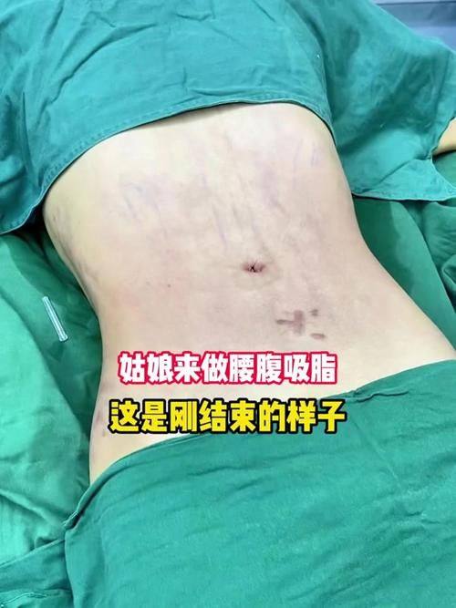 深圳兰茂梵美医疗美容诊所真人口碑评价怎么样？