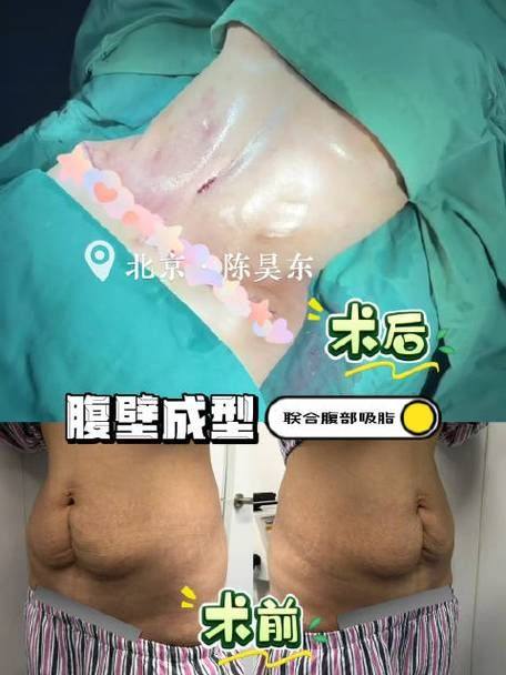 国内台湾菲仕美医疗美容诊所地址电话营业时间