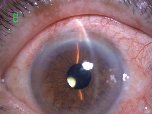 湖南省儿童医院眼科医生团队实力强大及骨干医生简介