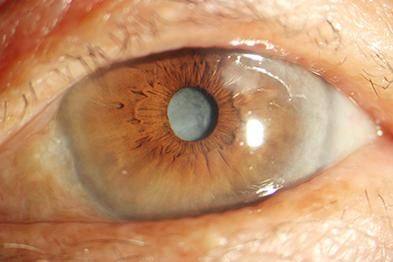 莱州市中医医院眼科收费价格表/收费标准