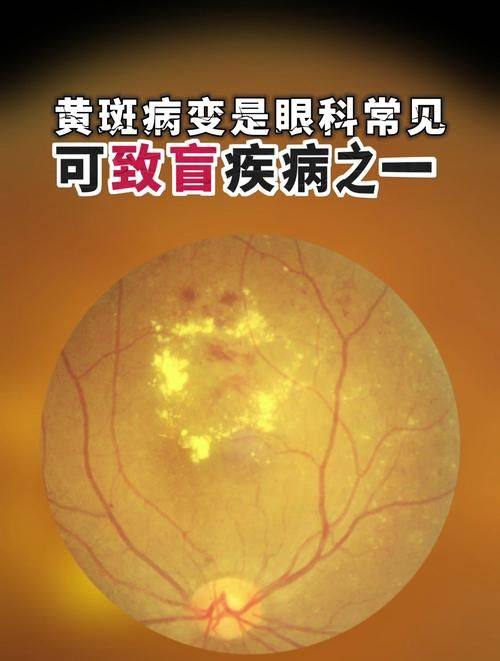 湖南省儿童医院眼科特色项目及技术优势