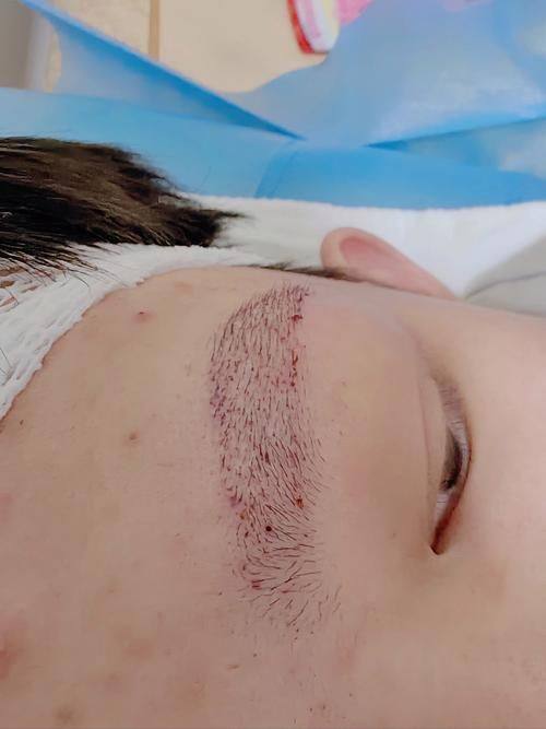 顺德港美修复医院整形美容科真人口碑评价怎么样?