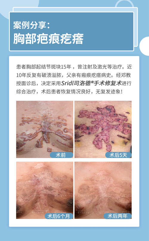 佛山黛颜人医疗美容详细的预约挂号方式及流程