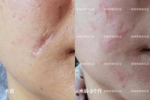 佛山黛颜人医疗美容是正规医院吗？