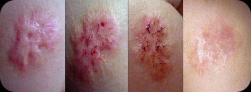 佛山医美恩整形医院详细的预约挂号方式及流程