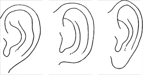 顺德港美修复医院整形美容科是正规医院吗?