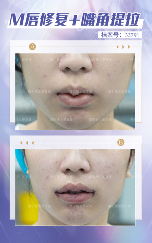 顺德港美修复医院整形美容科医生团队实力强大及骨干医生简介