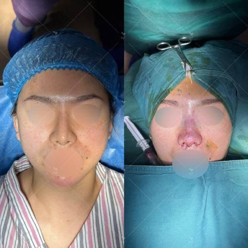 秦皇岛二伟医疗美容诊所真人口碑评价怎么样?